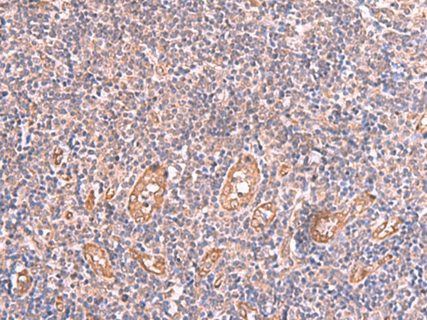 Immunohistochemistry of paraffin-embedded Human tonsil tissue  using LMCD1 Polyclonal Antibody at dilution of 1:100(?200)