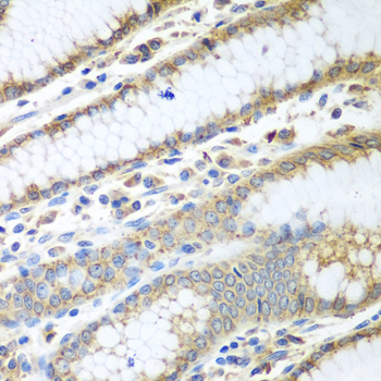 Immunohistochemistry of paraffin-embedded Human stomach using PDIA3 Polyclonal Antibody at dilution of  1:100 (40x lens).