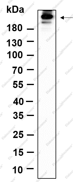 Recombinant Phospho-Acetyl-CoA Carboxylase (Ser79) Monoclonal Antibody - 1