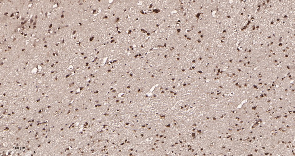 Recombinant p27 KIP 1 Monoclonal Antibody - small - 2