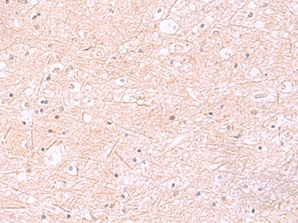 Immunohistochemistry of paraffin-embedded Human brain tissue  using RABEPK Polyclonal Antibody at dilution of 1:85(?200)