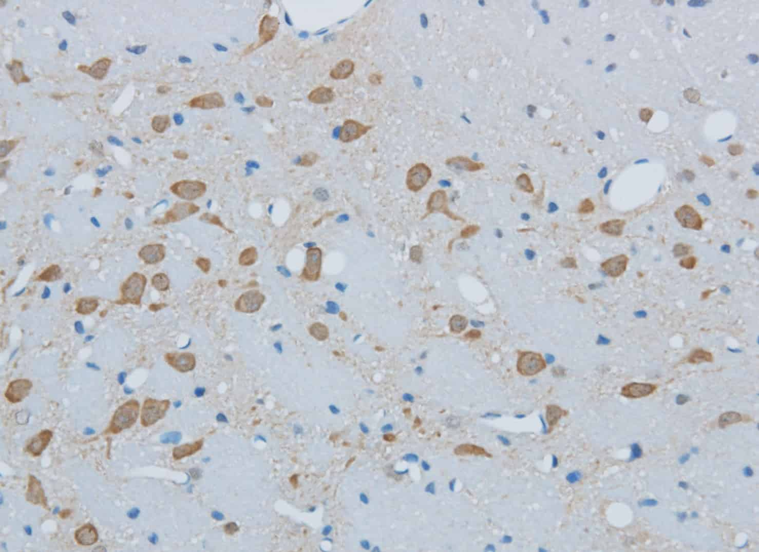 Immunohistochemistry of paraffin-embedded Mouse brain using TIMP4 Polyclonal Antibody at dilution of 1:50