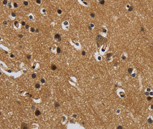 Immunohistochemistry of paraffin-embedded Human brain  tissue using GATA5 Polyclonal Antibody at dilution 1:50