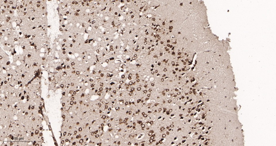 Recombinant YTHDF1 Monoclonal Antibody - small - 3