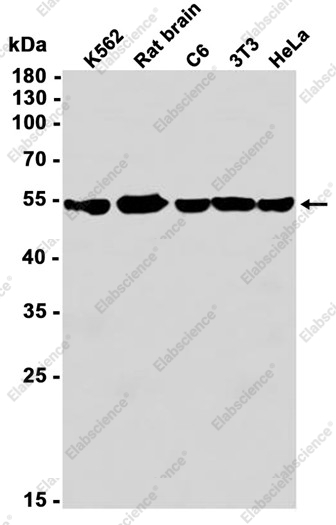 Recombinant Lipoamide Dehydrogenase Monoclonal Antibody - 1