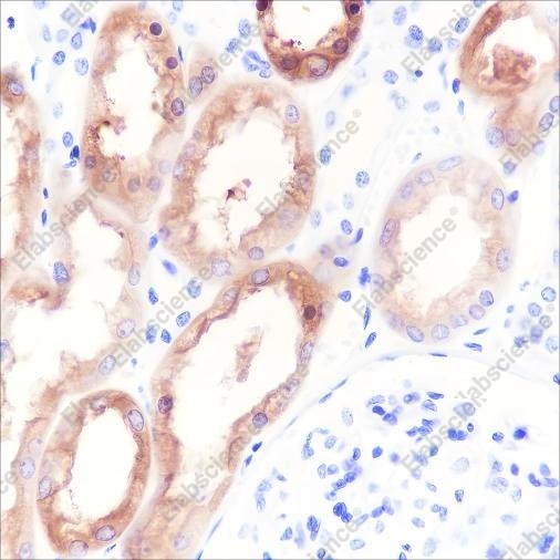 Recombinant HGD Monoclonal Antibody - 1