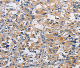 PKC epsilon Polyclonal Antibody - 3