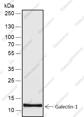 Recombinant Galectin-1 Monoclonal Antibody - 2