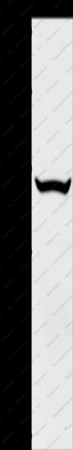 SLC33A1 Polyclonal Antibody - 1