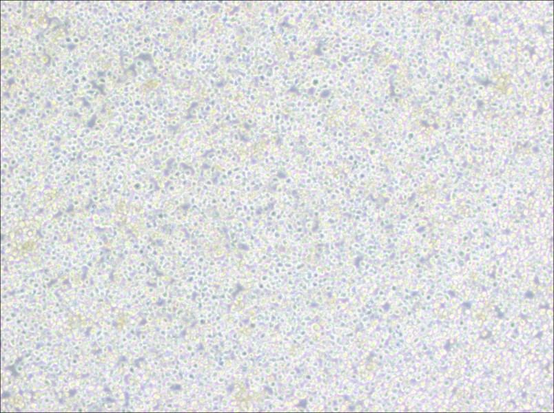 PC 61 5.3 [PC 61; PC 61.5.3] Cell Complete Medium - 2