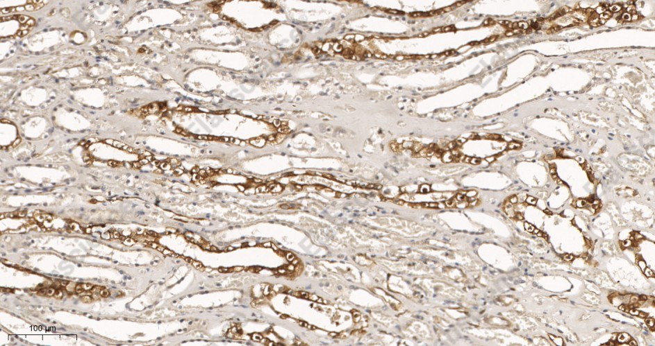 Recombinant STAT1 α Monoclonal Antibody - 2
