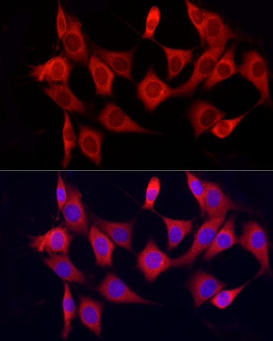 Immunofluorescence analysis of NIH/3T3 cells using CYP7B1 Polyclonal Antibody at dilution of 1:20 (40x lens). Blue: DAPI for nuclear staining.