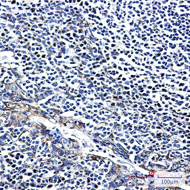 Recombinant FGFR3 Monoclonal Antibody - 3