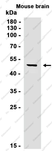 Recombinant beta IV Tubulin Monoclonal Antibody - 2