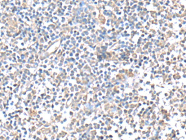 Immunohistochemistry of paraffin-embedded Human tonsil tissue  using IFI27 Polyclonal Antibody at dilution of 1:80(?200)