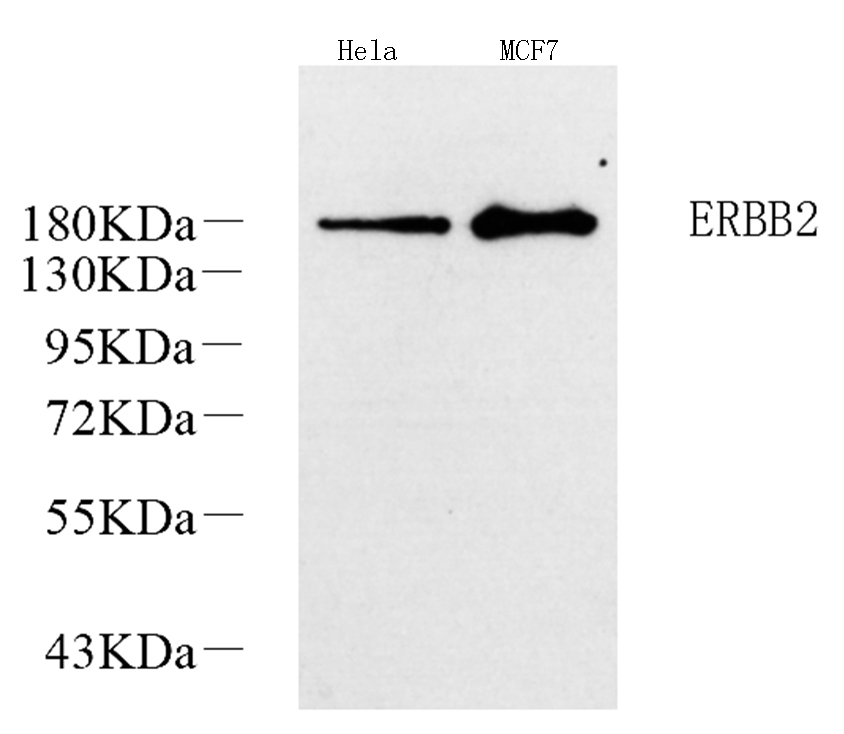 Western Blot analysis of various samples using ERBB2 Polyclonal Antibody at dilution of 1:1000.