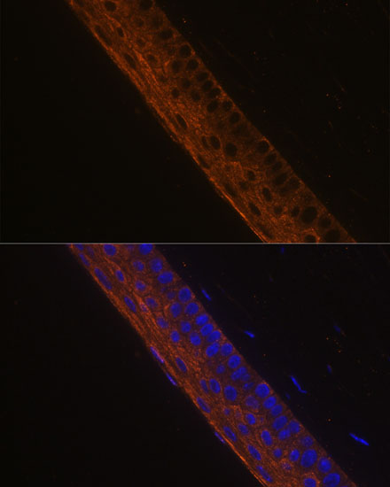 Immunofluorescence analysis of Mouse eye using MYH13 Polyclonal Antibody at dilution of  1:100 (40x lens). Blue: DAPI for nuclear staining.