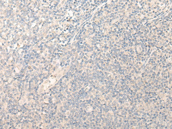 Immunohistochemistry of paraffin-embedded Human tonsil tissue  using RADIL Polyclonal Antibody at dilution of 1:40(?200)