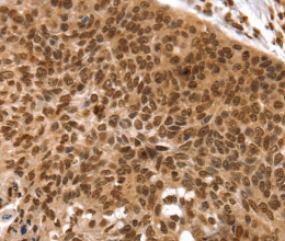 TAF10 Polyclonal Antibody - 2
