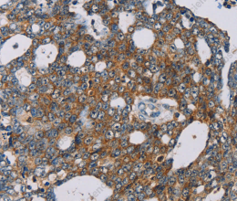 MRPL39 Polyclonal Antibody - 3