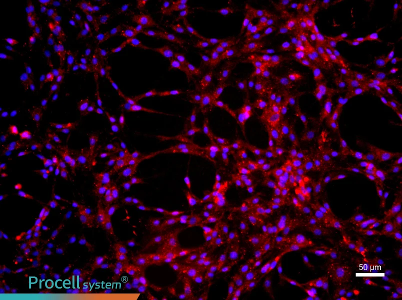 Rat Pulmonary Great Artery Endothelial Cell Complete Medium - 1