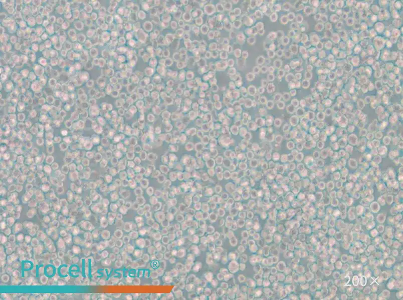 WIL2 S Cell Complete Medium - 5