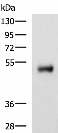 Western blot analysis of Human colorectal cancer tissue lysate  using METTL17 Polyclonal Antibody at dilution of 1:800