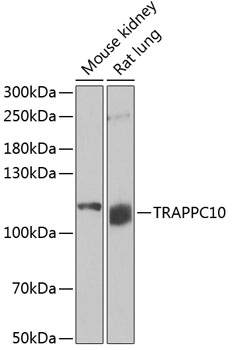 Western blot analysis of extracts of various cell lines using TRAPPC10 Polyclonal Antibody at 1:1000 dilution.