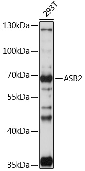 Western blot analysis of extracts of 293T cells using ASB2 Polyclonal Antibody at 1:1000 dilution.