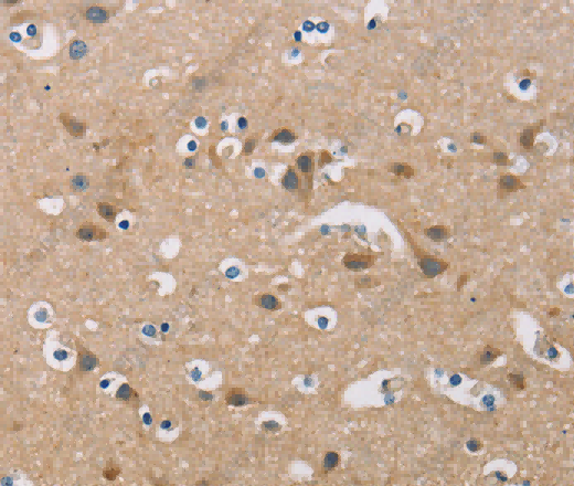 FXYD1 Polyclonal Antibody - 3