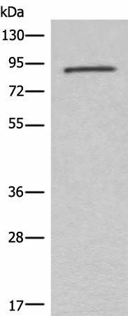 Western blot analysis of Mouse lung tissue lysate  using C7 Polyclonal Antibody at dilution of 1:800