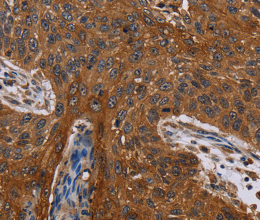 Catenin gamma Polyclonal Antibody - 3