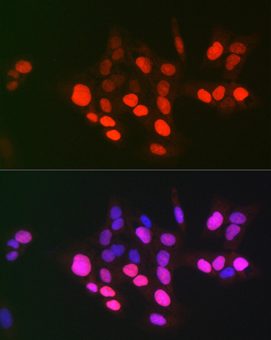 Immunofluorescence analysis of U-2 OS cells using DNA topoisomerase II alpha Polyclonal Antibody at dilution of 1:100 (40x lens). Blue: DAPI for nuclear staining.