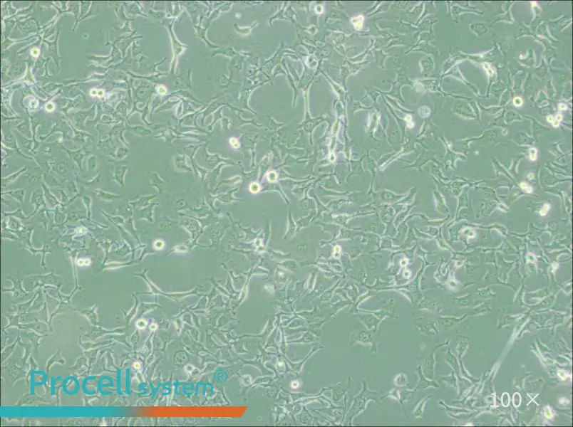 KYSE-410 Cell Complete Medium - 3