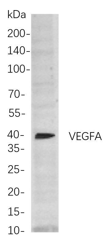 Recombinant VEGFA Monoclonal Antibody-searchlist-1