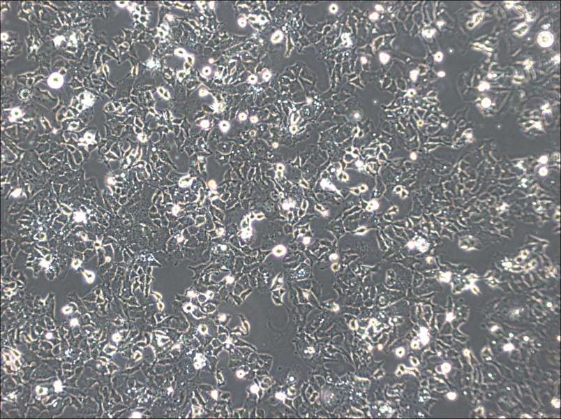 Ishikawa Cell Complete Medium - 3