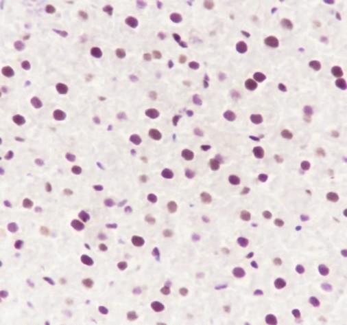 Recombinant ATF1 Monoclonal Antibody - small - 5