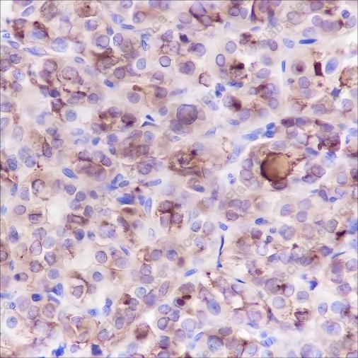Recombinant Thyroglobulin Monoclonal Antibody - 1