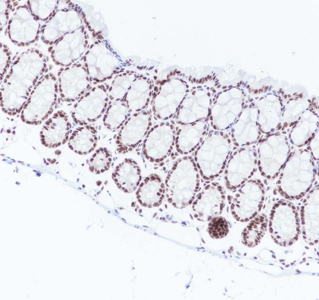 Recombinant NELF-B Monoclonal Antibody - small - 4