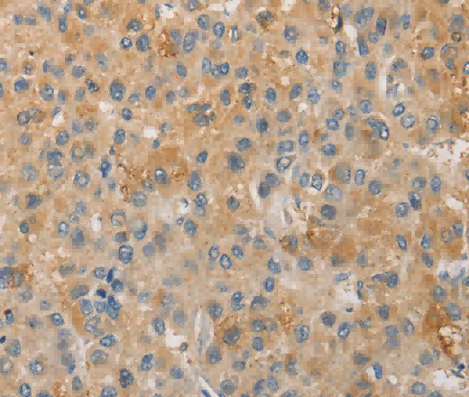 NFE2L1 Polyclonal Antibody - 2