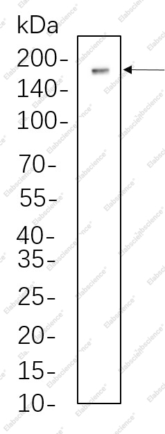 Recombinant Dnmt1 Monoclonal Antibody - 1