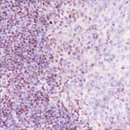 Recombinant SATB1 Monoclonal Antibody - 2