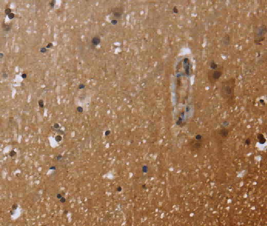 FHL3 Polyclonal Antibody - 3