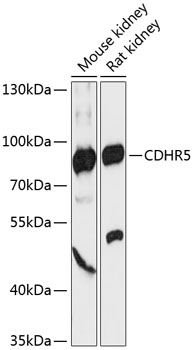 Western blot analysis of extracts of various cell lines using CDHR5 Polyclonal Antibody at 1:3000 dilution.