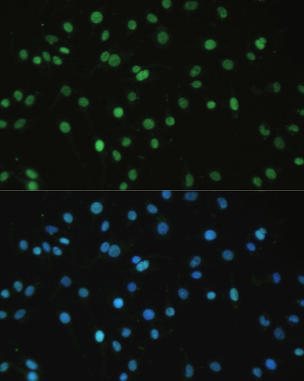 Immunofluorescence analysis of C6 cells using SET Polyclonal Antibody at dilution of 1:100. Blue: DAPI for nuclear staining.