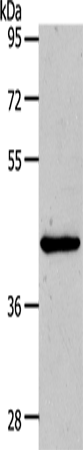 Western Blot analysis of Hela cell using MMP13 Polyclonal Antibody at dilution of 1:500