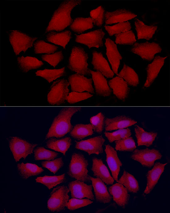 Immunofluorescence analysis of U2OS cells using VDR Polyclonal antibody at dilution of 1:200 (40x lens). Blue: DAPI for nuclear staining.