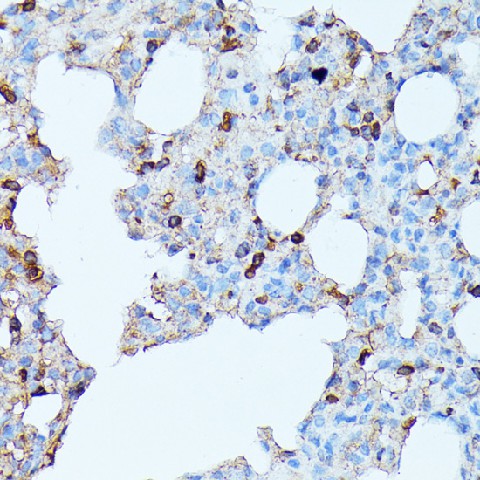 Immunohistochemistry of paraffin-embedded Rat lung using CXCR1 Polyclonal Antibody at dilution of  1:100 (40x lens).