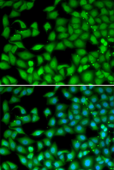 Immunofluorescence analysis of MCF-7 cells using RTKN Polyclonal Antibody