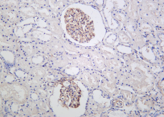 Recombinant ILK Monoclonal Antibody - small - 2